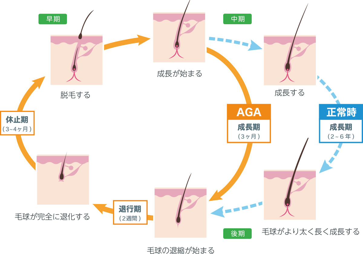 キューティクルCMC